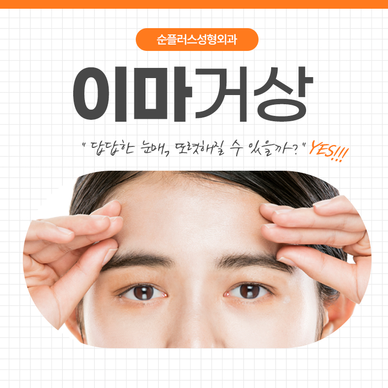 이마거상잘하는곳 어떤 부분을 알아봐야할까요 관련 이미지 1