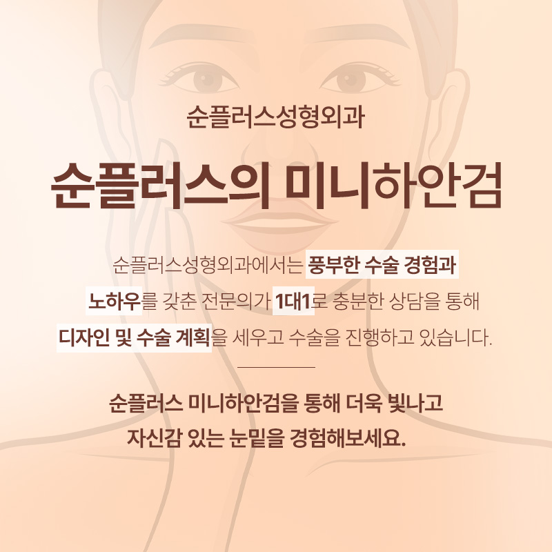 Mini Lower Blepharoplasty Depending on the Degree of Under-Eye Sagging image 6