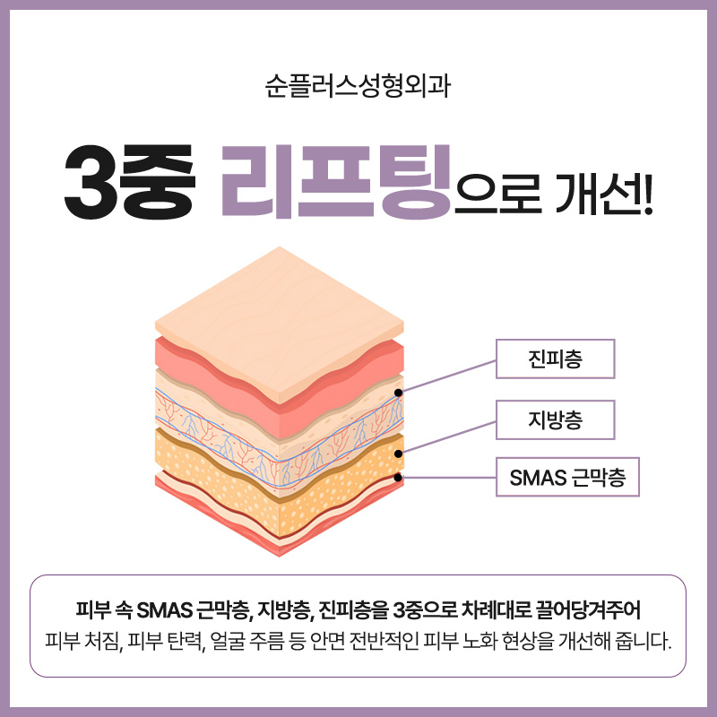 Will the Effects of a Facelift Last a Long Time? image 3