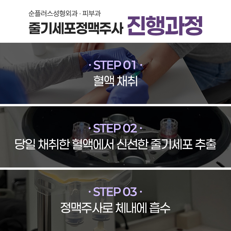 줄기세포주사 정맥을 통해 손상된 세포의 재생을 관련 이미지 5