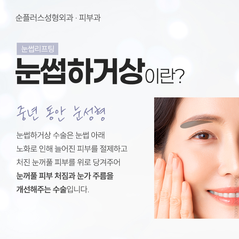 Ptosis, Improve It with the Right Method Depending on the Type | Brow Lift image 3