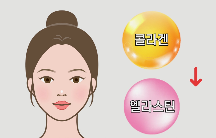 윤곽수술 후 리프팅 혹은 살처짐 개선 리프팅 방법은 관련 이미지 1