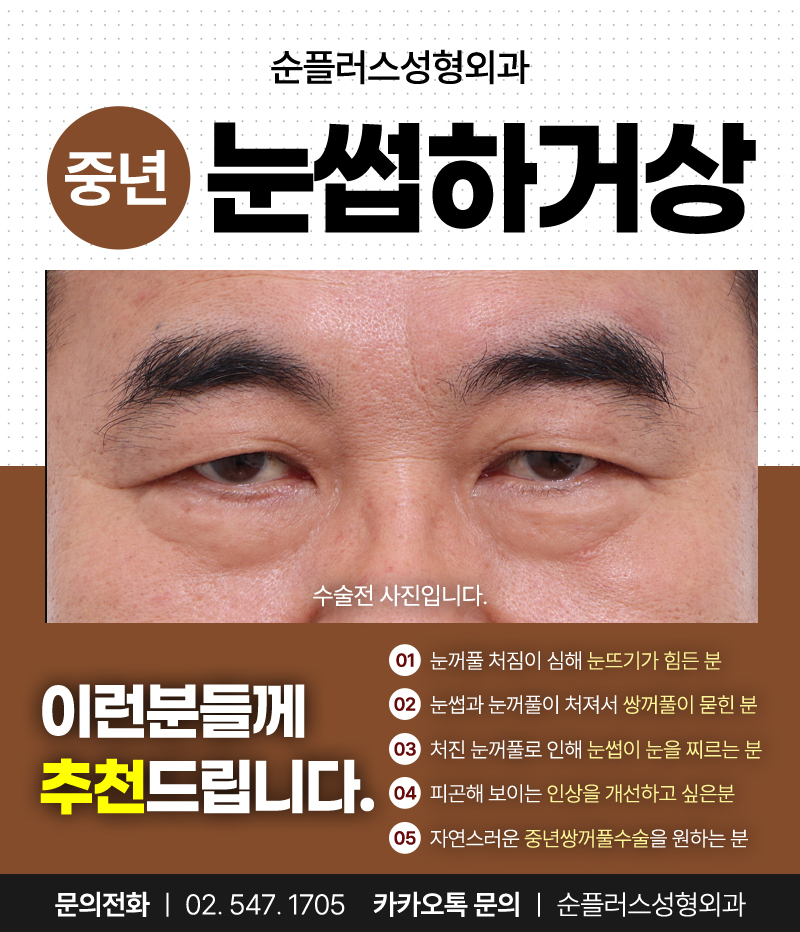 Making Parents’ Drooping Eyelids Look Clearer with the Effect of a Sub-Brow Lift image 7