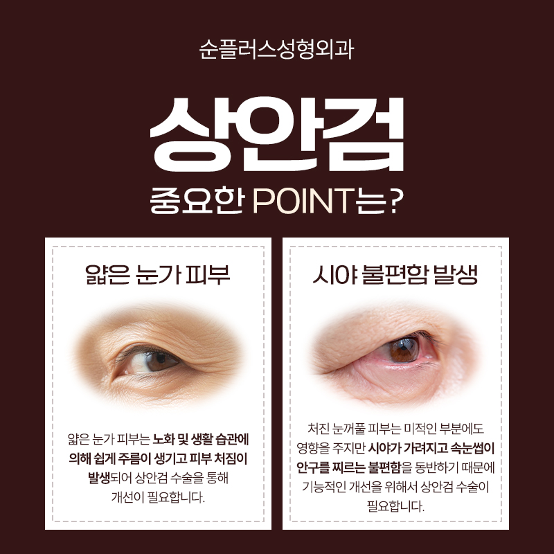 상안검수술 단순 처진눈꺼풀 수술이 아닌 기능과 구조를 파악해 관련 이미지 3