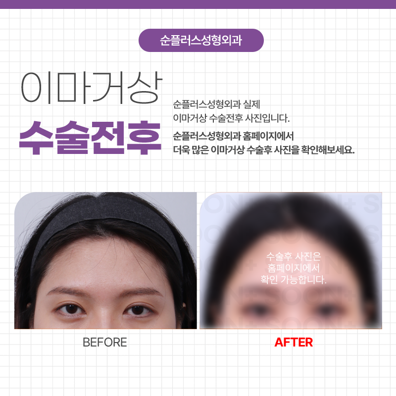 이마거상술 효과 유지를 높이기 위해 관련 이미지 5