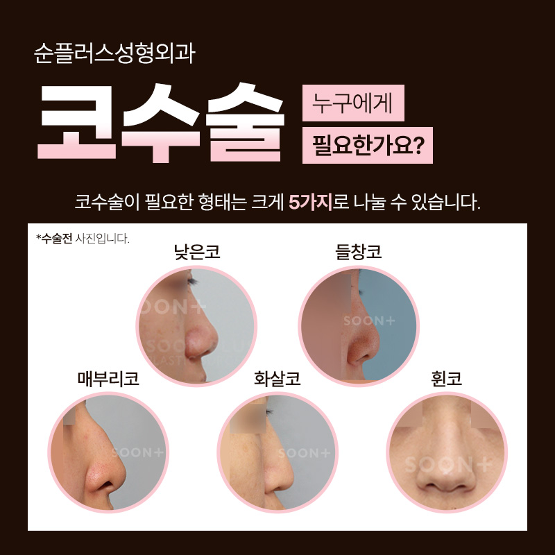 코성형수술 세밀한 분석을 통해 관련 이미지 3