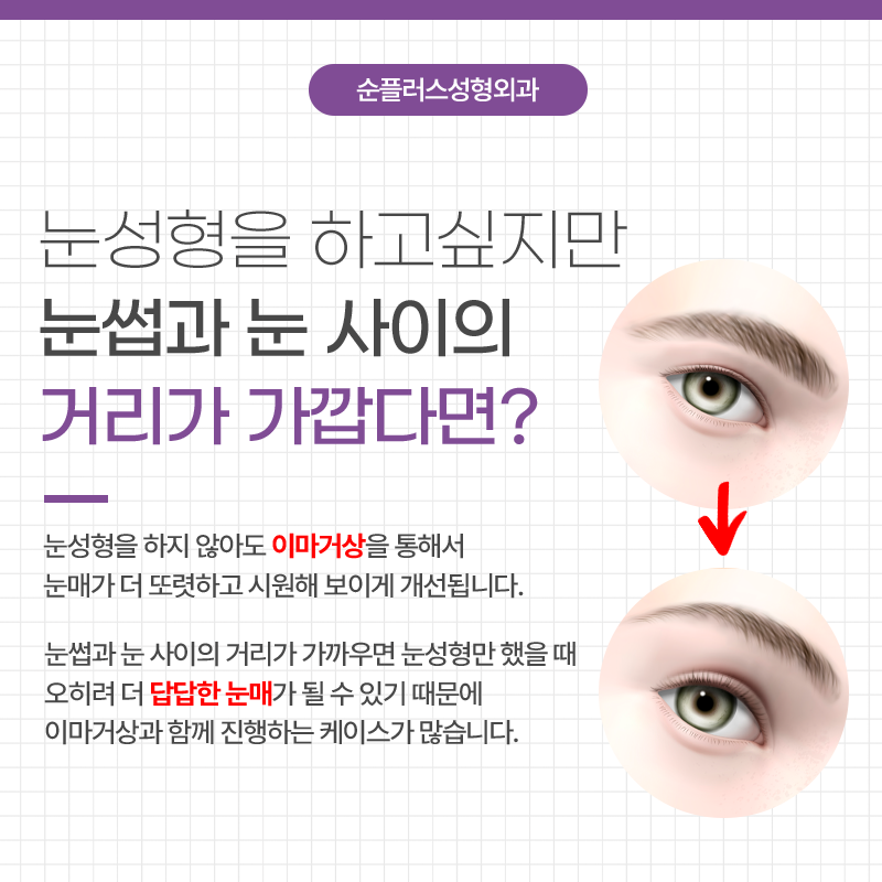 이마거상술 효과 유지를 높이기 위해 관련 이미지 3