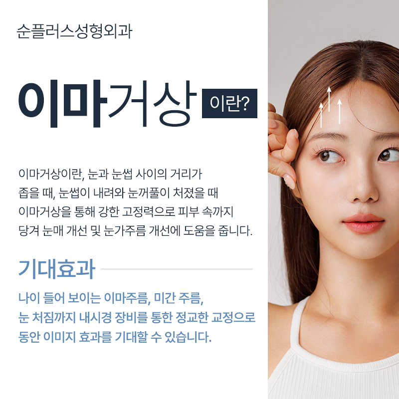내시경이마거상 잘하는곳 눈성형의 효과까지 관련 이미지 2