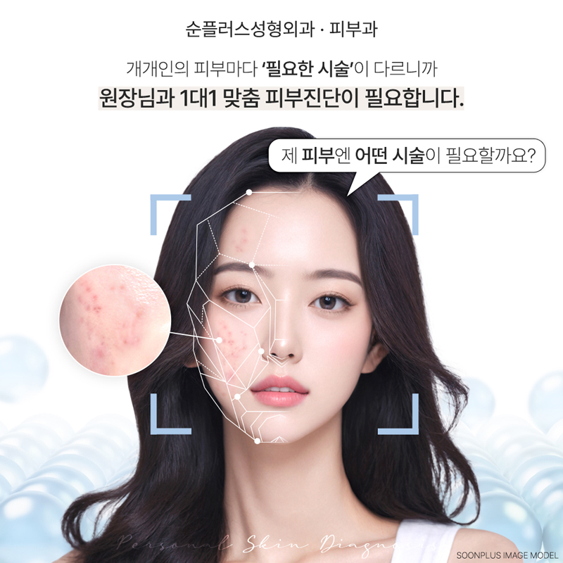 신사역 남자레이저제모 수염자국 지우고 깔끔한 인상 관련 이미지 4