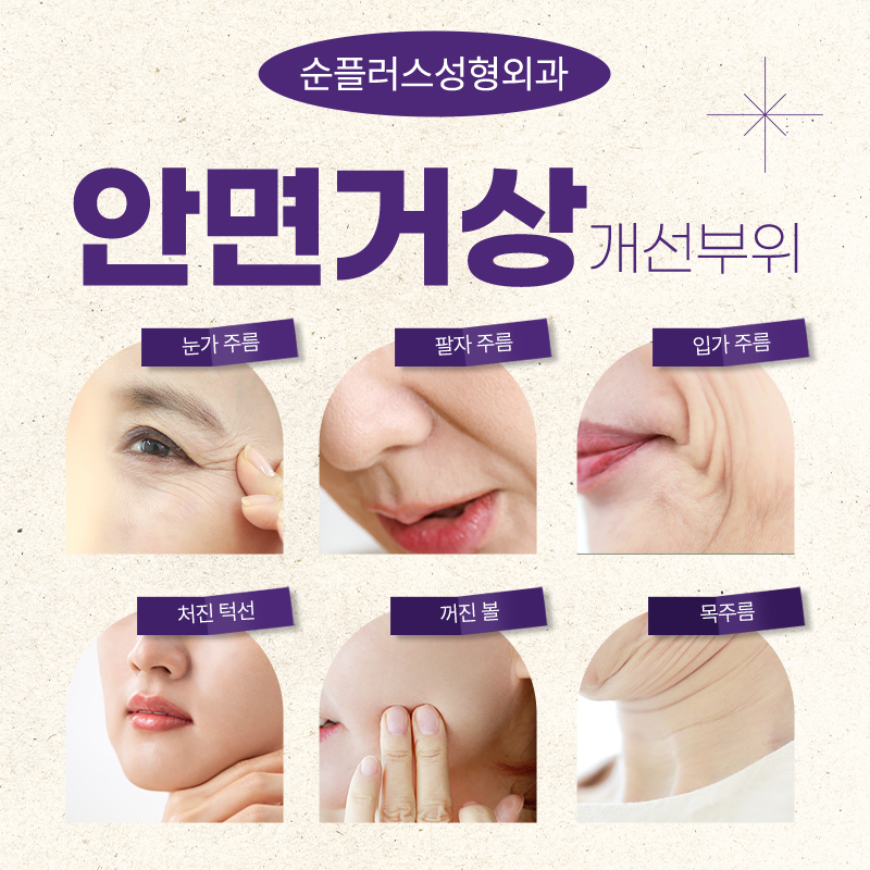 Facelift Surgery: Lifting Diagnosis According to Skin Condition Changes with Age image 4