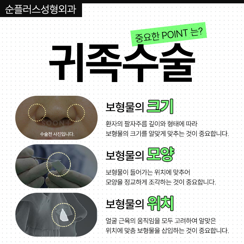 움푹한 코옆꺼짐으로 팔자주름 부각이 신경쓰인다면 맞춤보형물 귀족수술 통해 관련 이미지 4