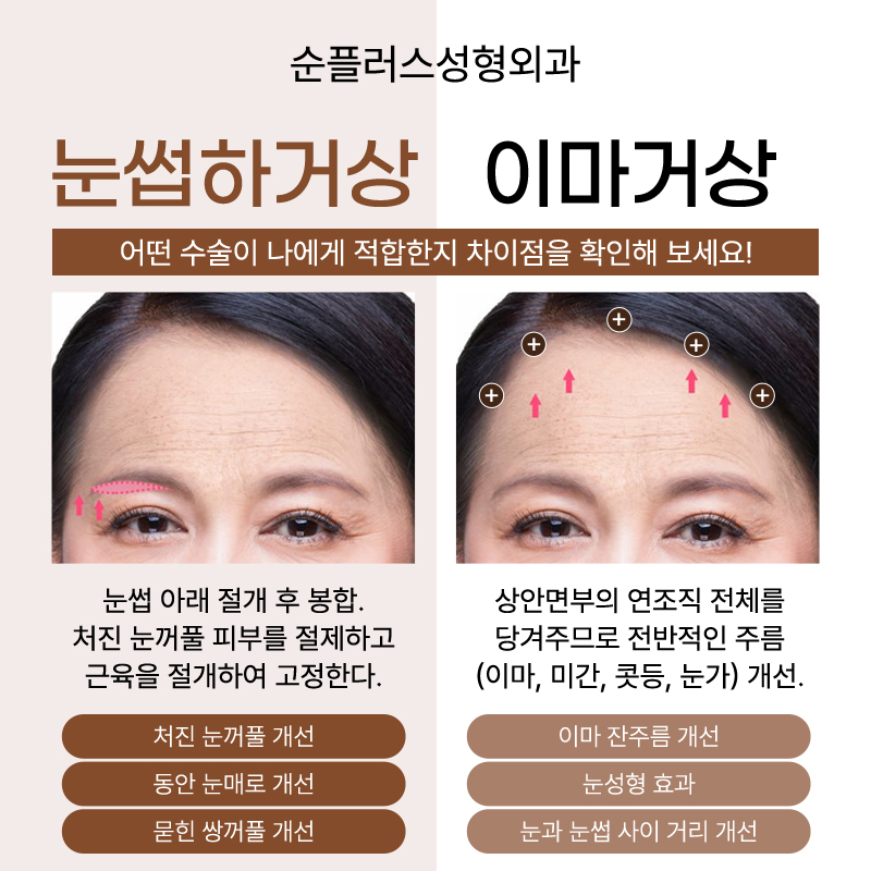 Making Parents’ Drooping Eyelids Look Clearer with the Effect of a Sub-Brow Lift image 4