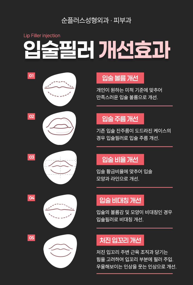 자연스러운 입술필러 유명한곳 선택에 앞서 관련 이미지 4