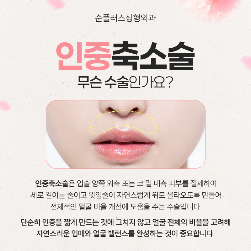 Philtrum Reduction Surgery: Harmonious Proportions Between the Nose and Lips image 2