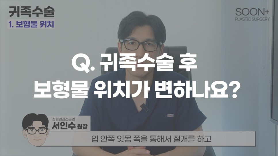 귀족수술ㅣ보형물 이동,교체 부터 뼈수술 가능 여부, 감각변화, 재교정까지 귀족수술 질문 모음집 관련 이미지 1
