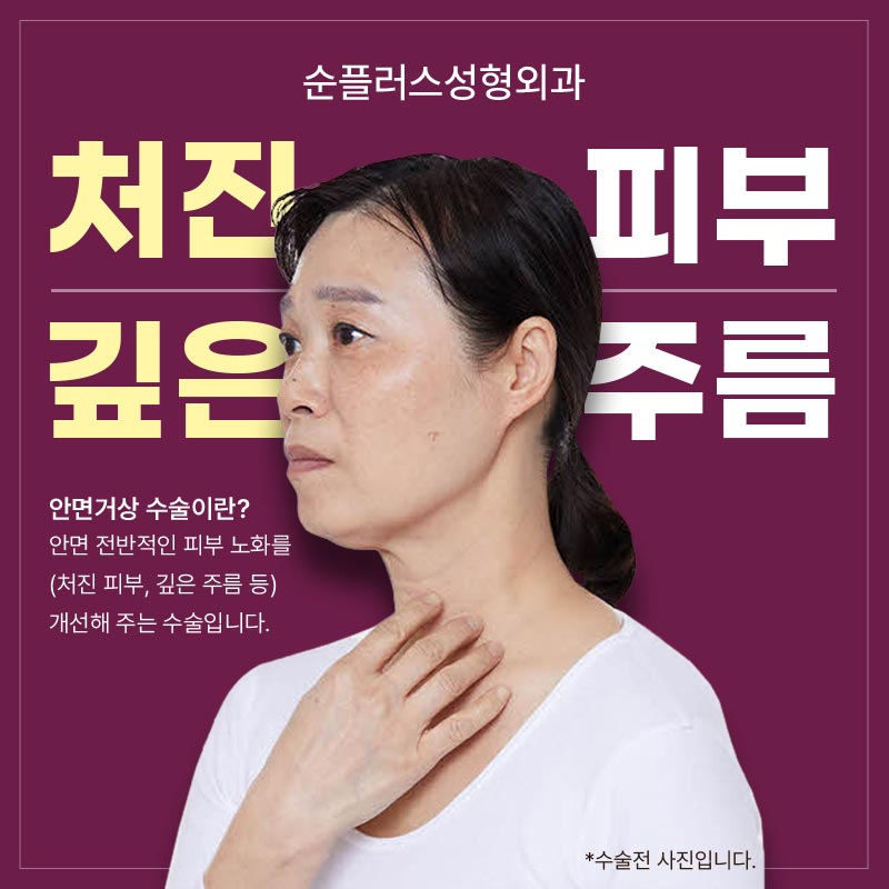 About the Effects of Facelift Surgery, Scarring, and Recovery Time image 2