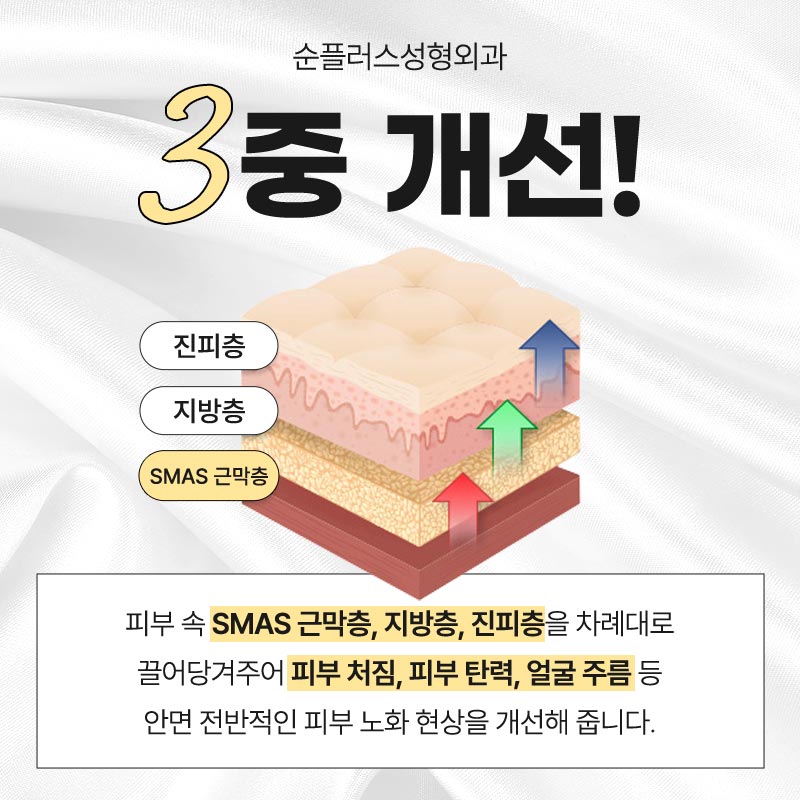 안면거상 근막층까지 당겨주는 스마스리프팅 통해 관련 이미지 3