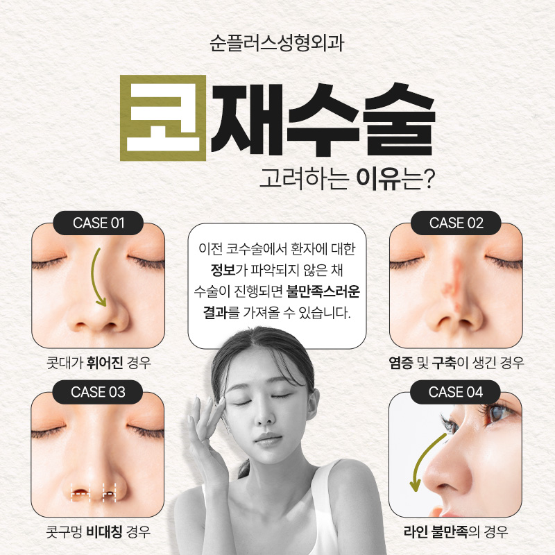 Revision Rhinoplasty Clinic to Avoid a Third or Fourth Surgery image 2