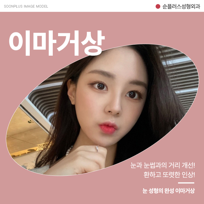 이마주름수술 자연스러운 개선방안을 위해 관련 이미지 1