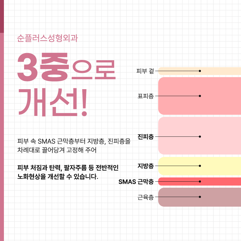 For people in their 50s and 60s, lifting should be done in three layers, including the SMAS image 3