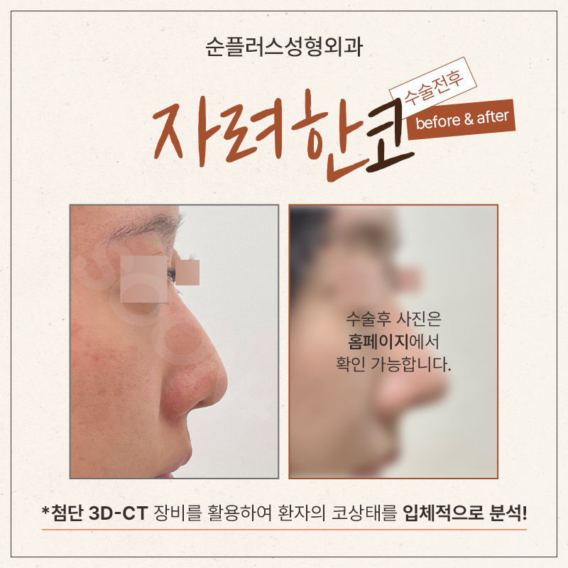 A Polished Nose Line Completed with a One-on-One Customized Plan image 5