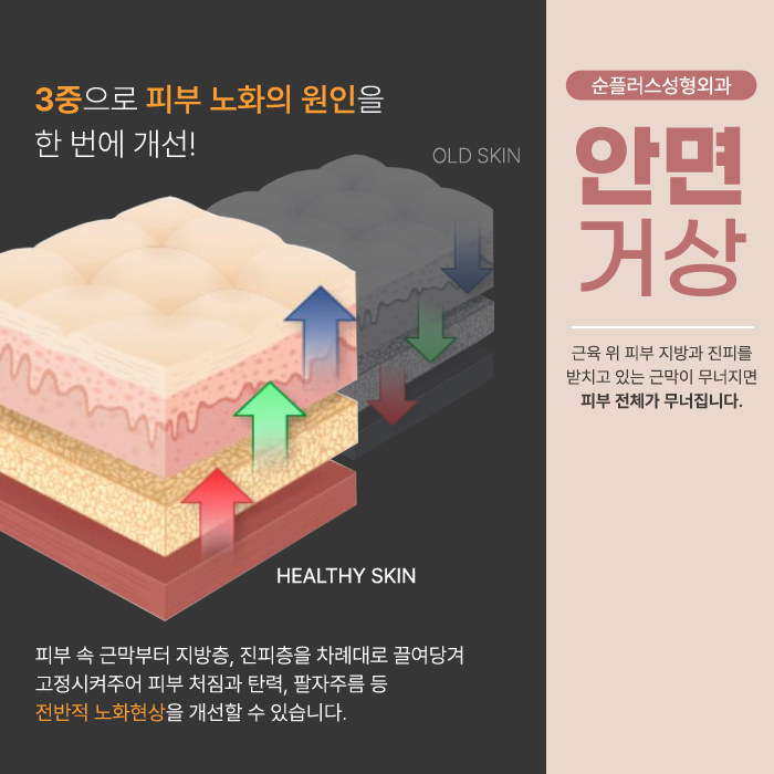 강남안면거상 피부가 광범위하게 처졌다면 관련 이미지 4