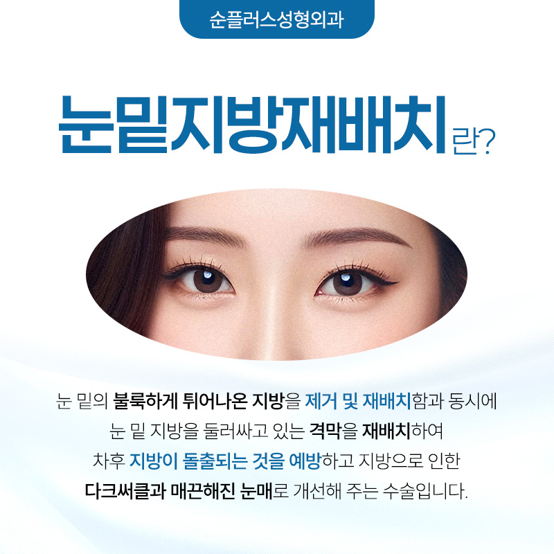 눈밑지방재배치수술 회복은 빠르게 재발은 없도록 관련 이미지 2