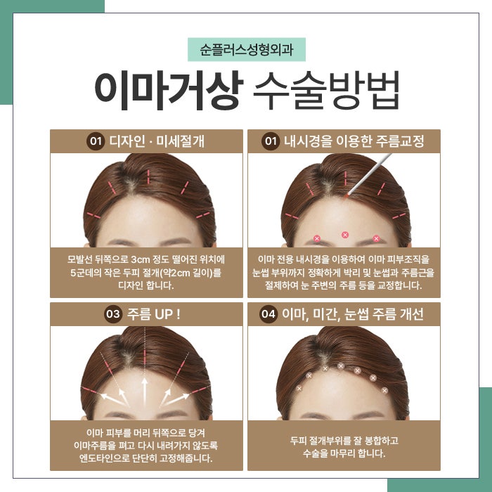 이마거상잘하는병원 나이가 많아도 적어도 관련 이미지 3