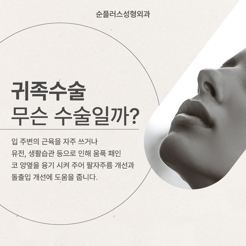 팔자주름보형물 개인별 맞춤 제작이 된다고? 관련 이미지 2