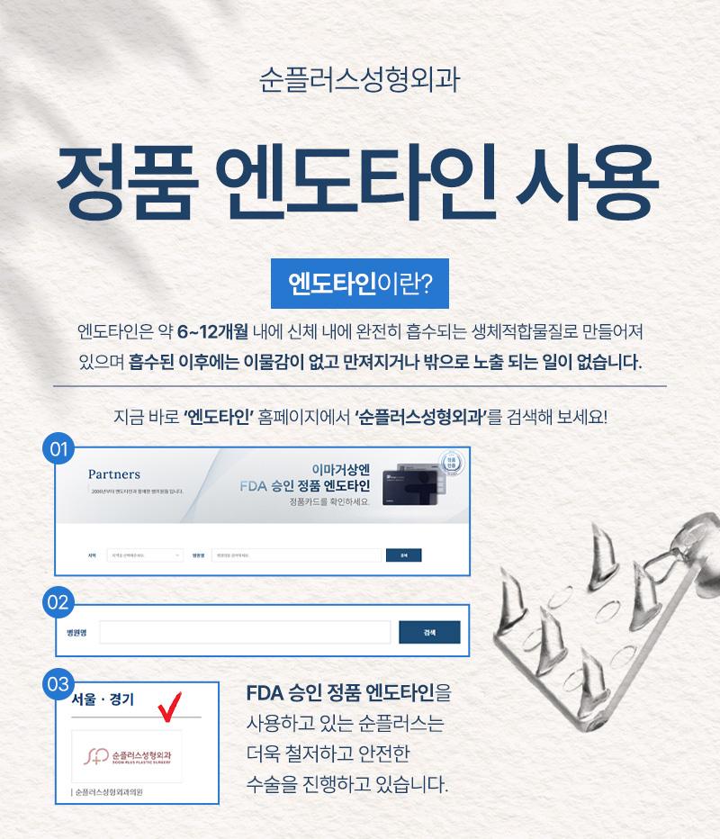 내시경이마거상 붓기, 유지기간 등 회복에 대해 관련 이미지 6