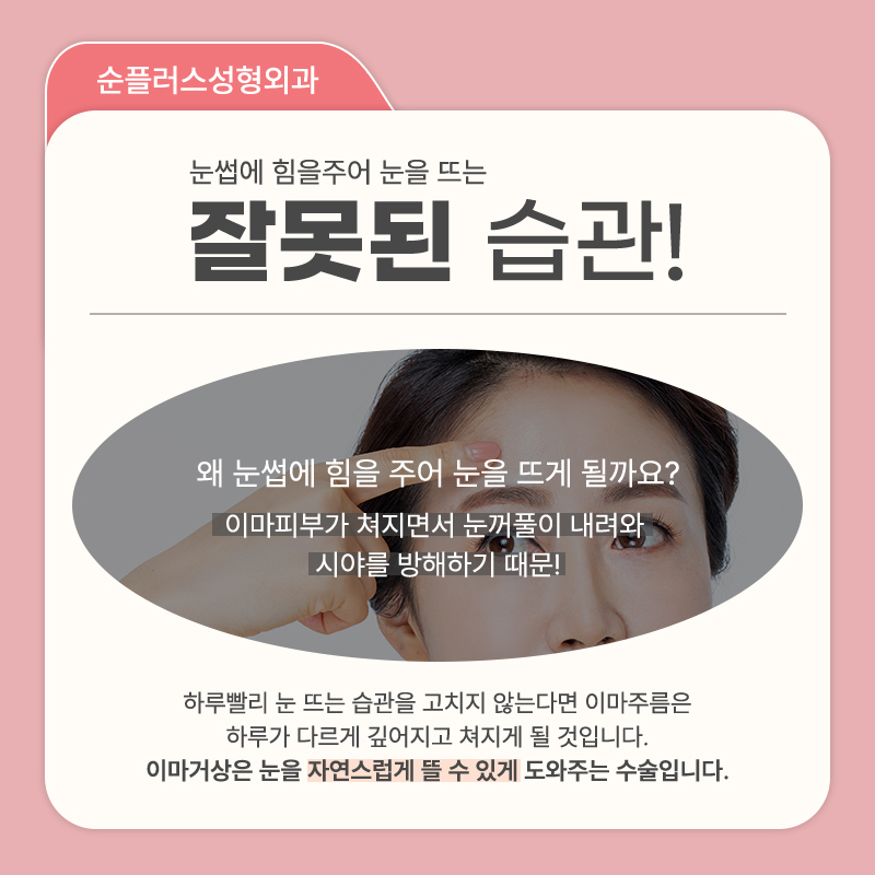 내시경 이마거상술 눈주변 주름개선에도 관련 이미지 3