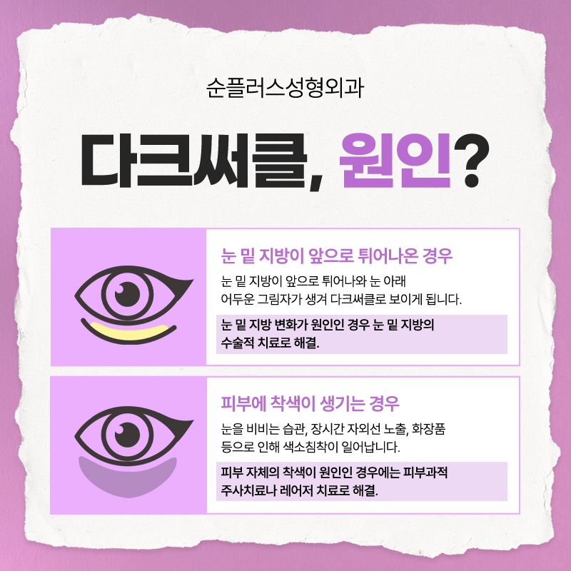 눈밑지방재배치잘하는병원, 결과 차이를 만드는 병원 선택 기준 관련 이미지 4