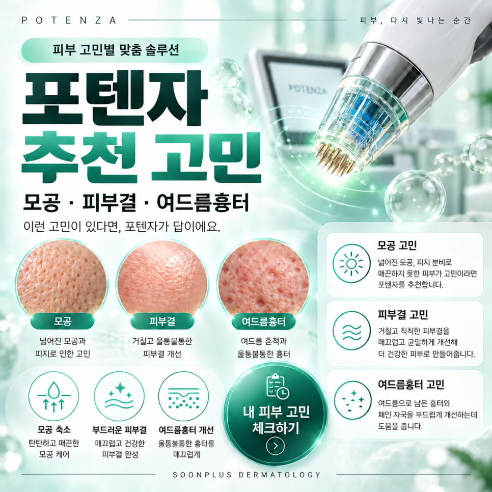 포텐자 모공, 여드름흉터 효과 있을까? 통증부터 회복기간까지 알아보기 관련 이미지 2