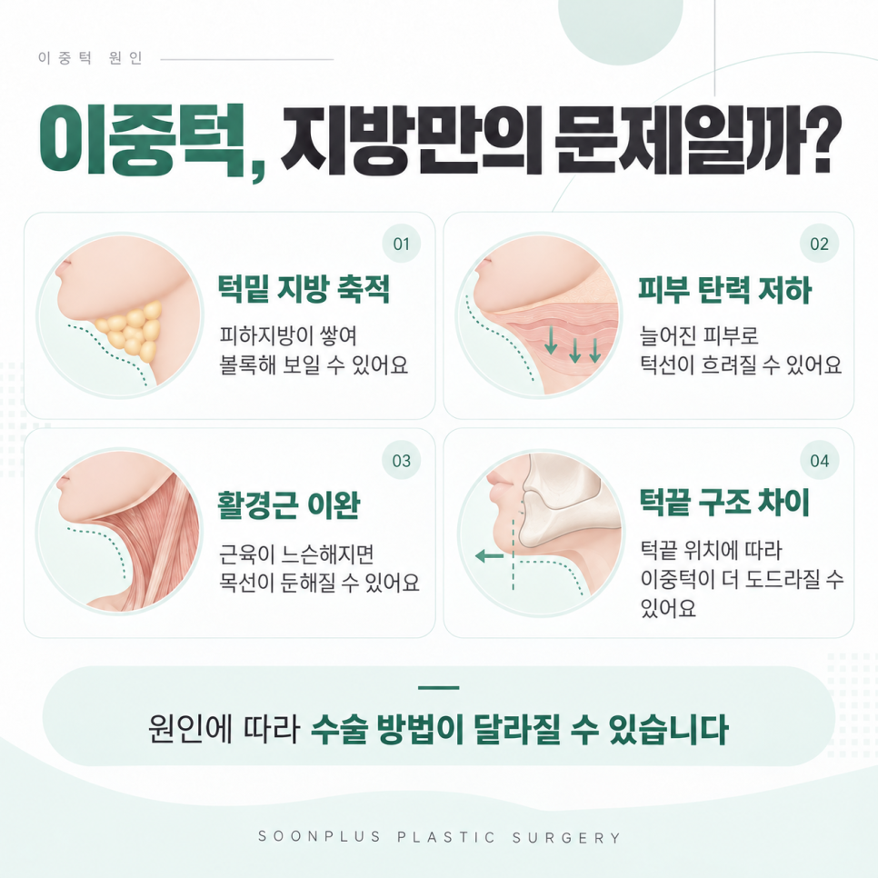 이중턱지방흡입과 이중턱근육묶기, 내 얼굴에 맞는 수술은? 관련 이미지 2