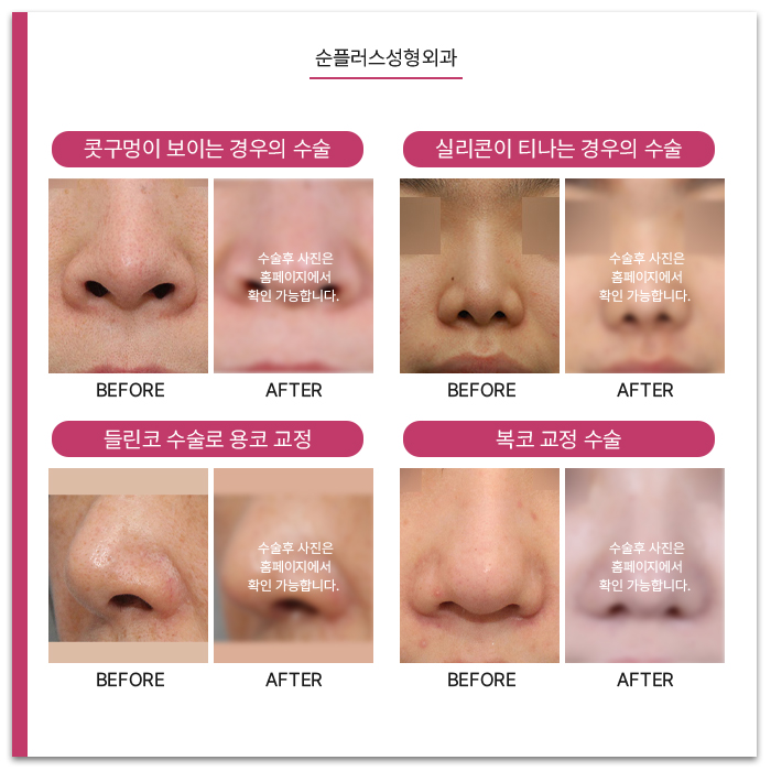 신사역 코재수술 이전에 무엇이 부족했었는지 관련 이미지 5