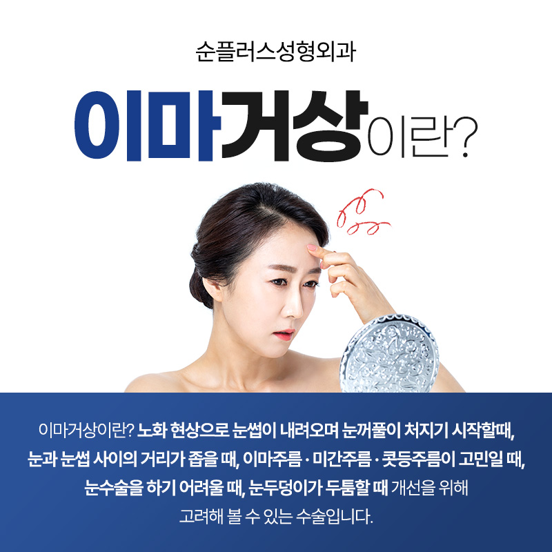 Differences in the Effect of Endoscopic Forehead Lift by Age image 2