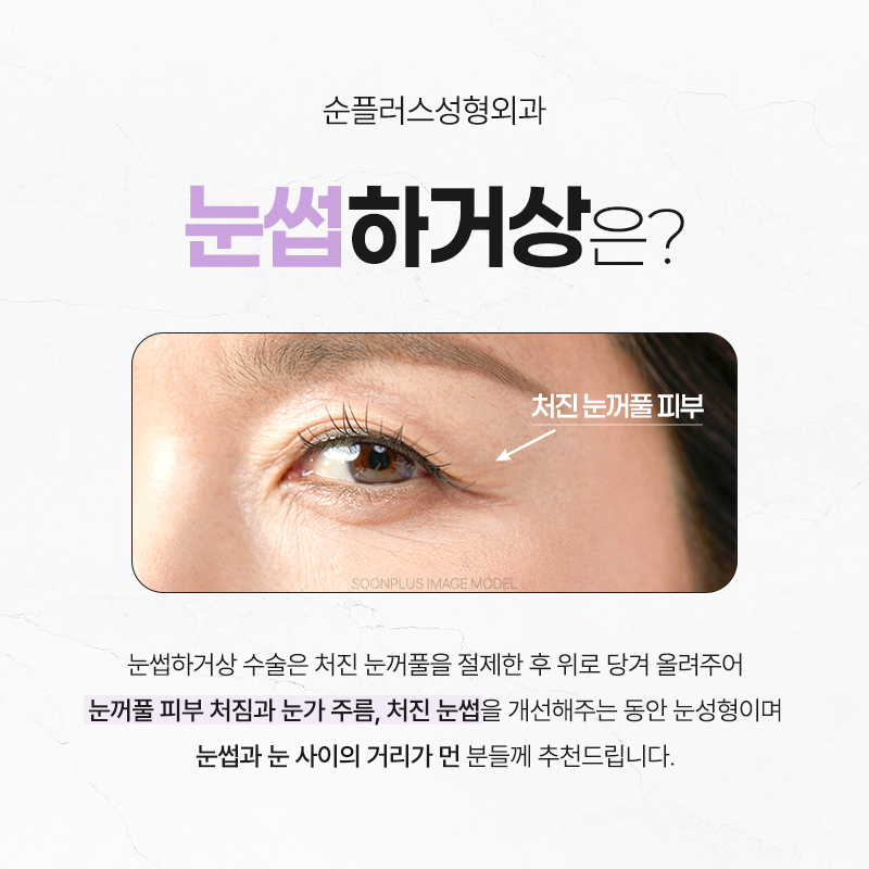 50대 60대 눈썹하거상, 자연스러운 동안 인상의 핵심은 따로 있다. 관련 이미지 2