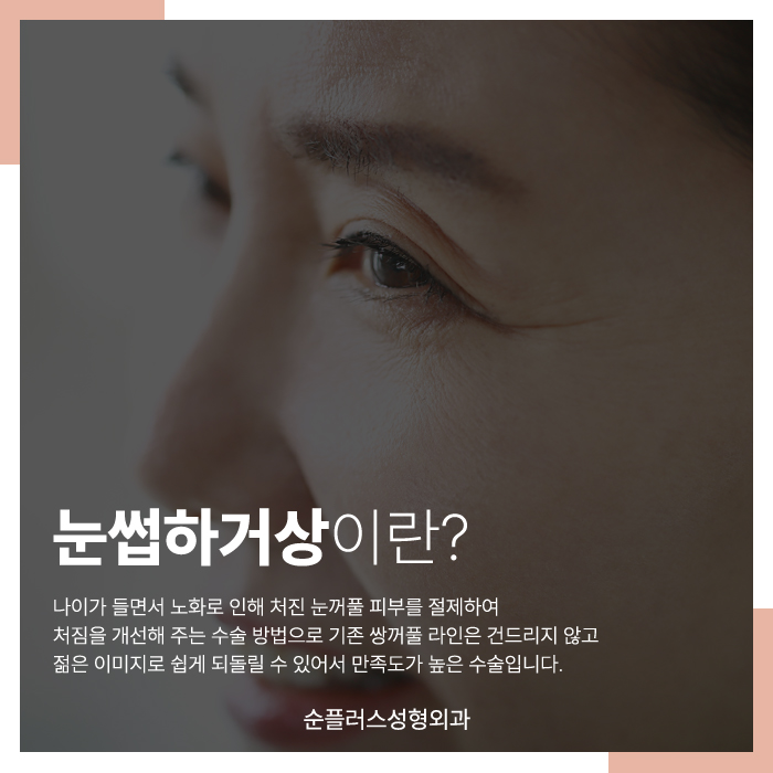 For Eye Shape Changes Through Midlife Eyelid Drooping Surgery image 2