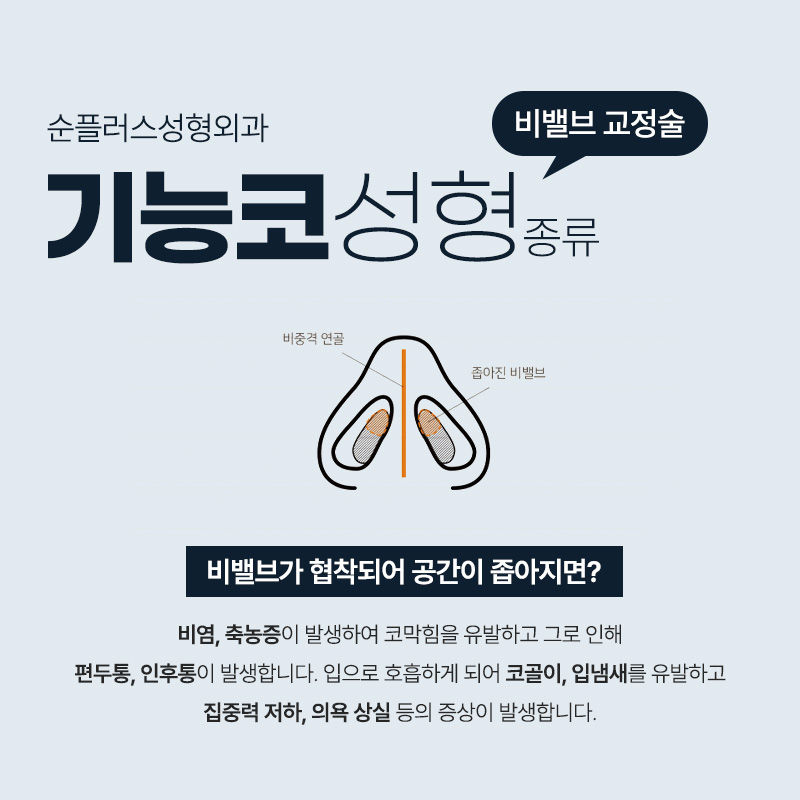 기능코성형ㅣ비중격만곡증, 비밸브재건술 등 기능적 부분까지 관련 이미지 5