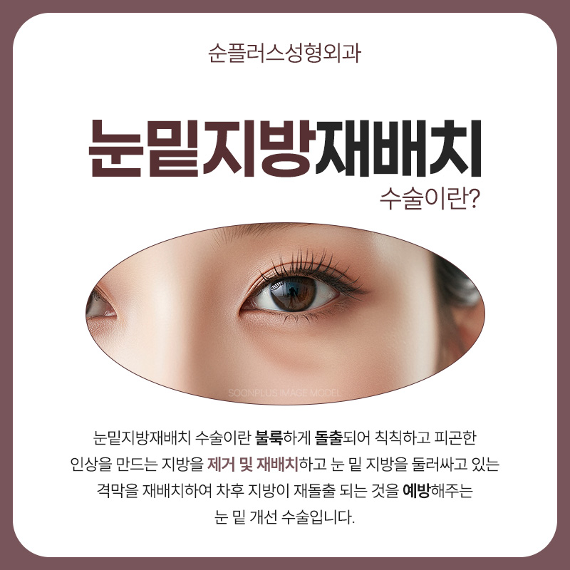 Why Under-Eye Fat Develops and Why Under-Eye Fat Repositioning May Be Needed image 2