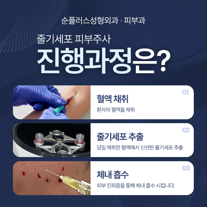 줄기세포피부주사 가격도 효과도 중요하니까 관련 이미지 5