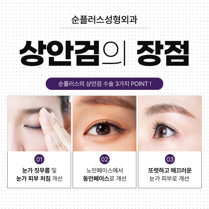 중년쌍꺼풀수술 처짐은 자연스럽게 관련 이미지 4