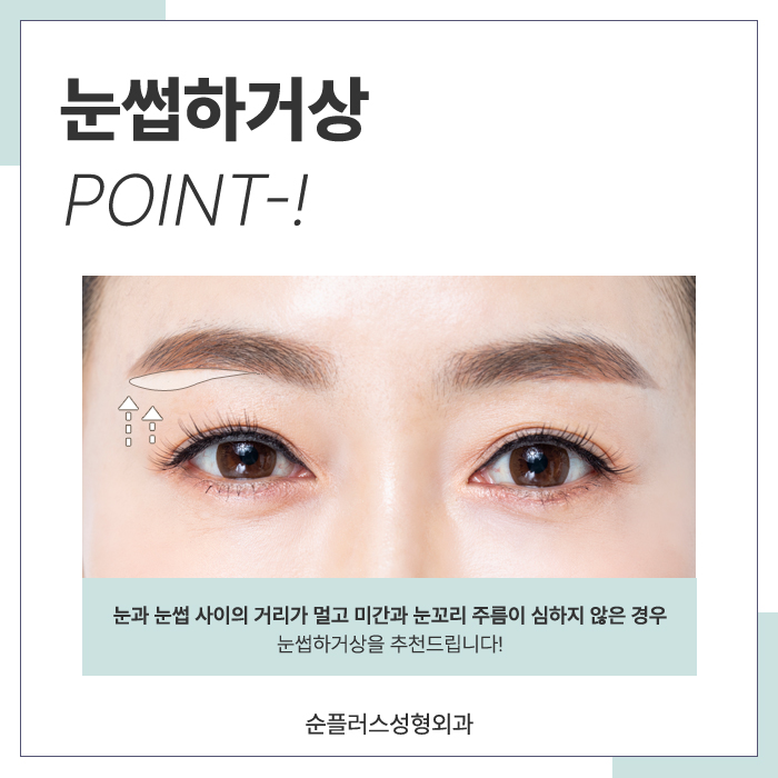 눈썹거상수술 자연스러움을 살리며 관련 이미지 3