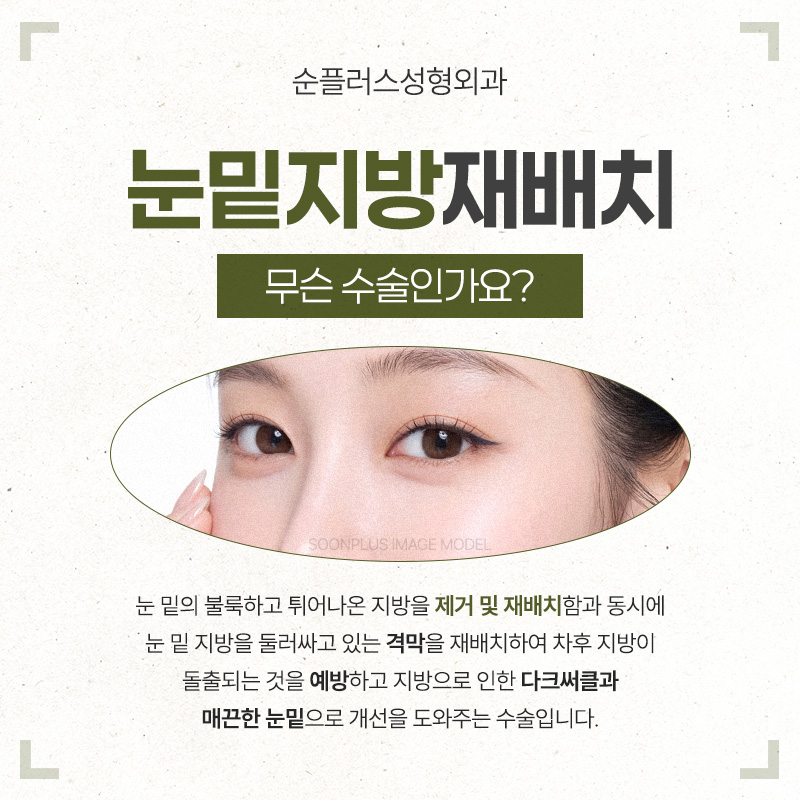 Under-Eye Fat Repositioning Effect - What if Bulging Under-Eye Fat Is Removed? image 2