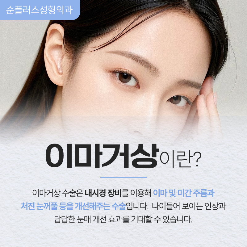 처진 이마와 눈썹, 이마리프팅(이마거상)으로 어떻게 달라질까 관련 이미지 2