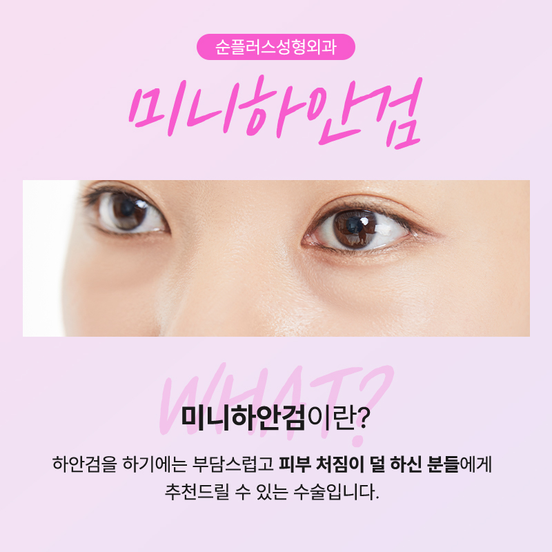 If Under-Eye Sagging Has Started: Mini Lower Blepharoplasty! image 2