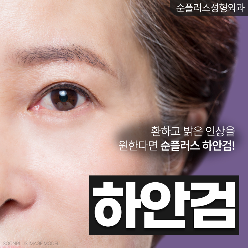 Appropriate Midlife Lower Eyelid Surgery with the Right Surgical Method image 1