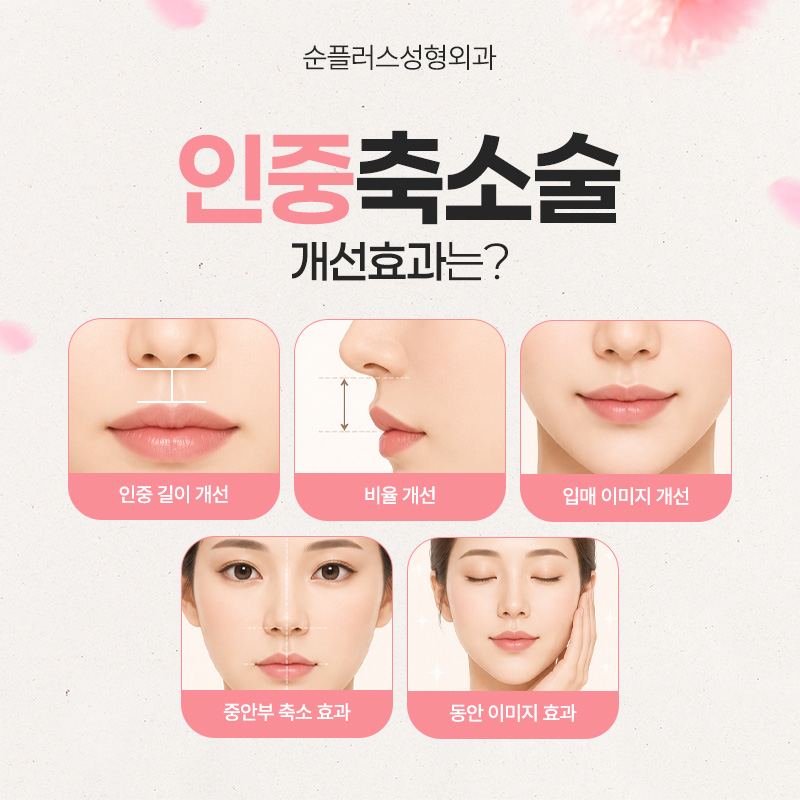 Philtrum Reduction Surgery: Harmonious Proportions Between the Nose and Lips image 4