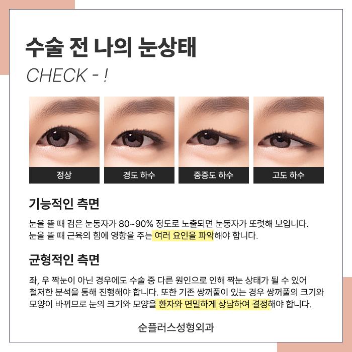 For Eye Shape Changes Through Midlife Eyelid Drooping Surgery image 4
