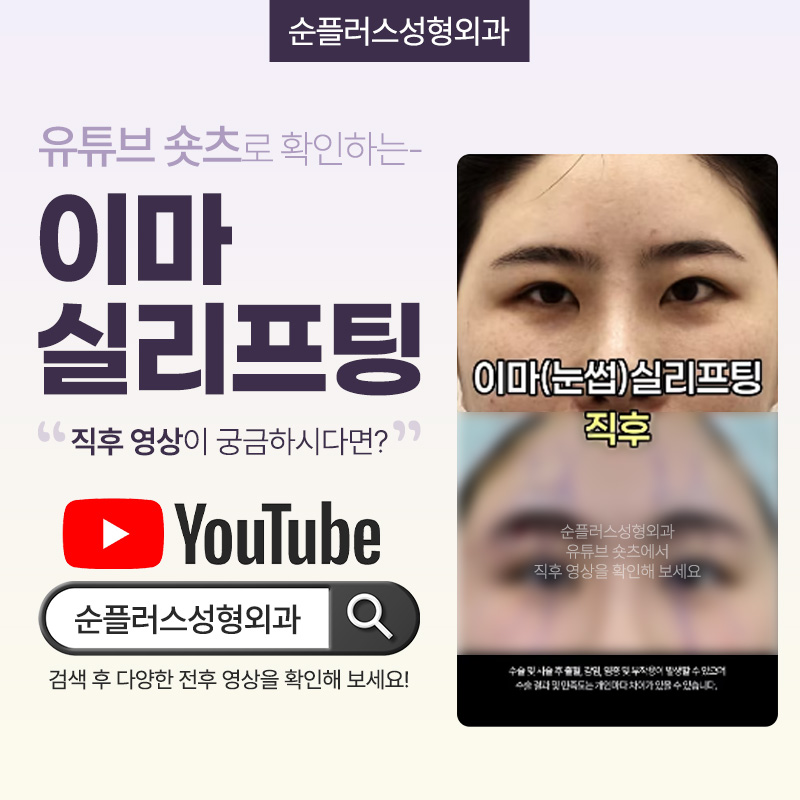 Forehead Thread Lifting - A More Refreshed Eye Area Effect with Naturally Lifted Eyebrows image 6